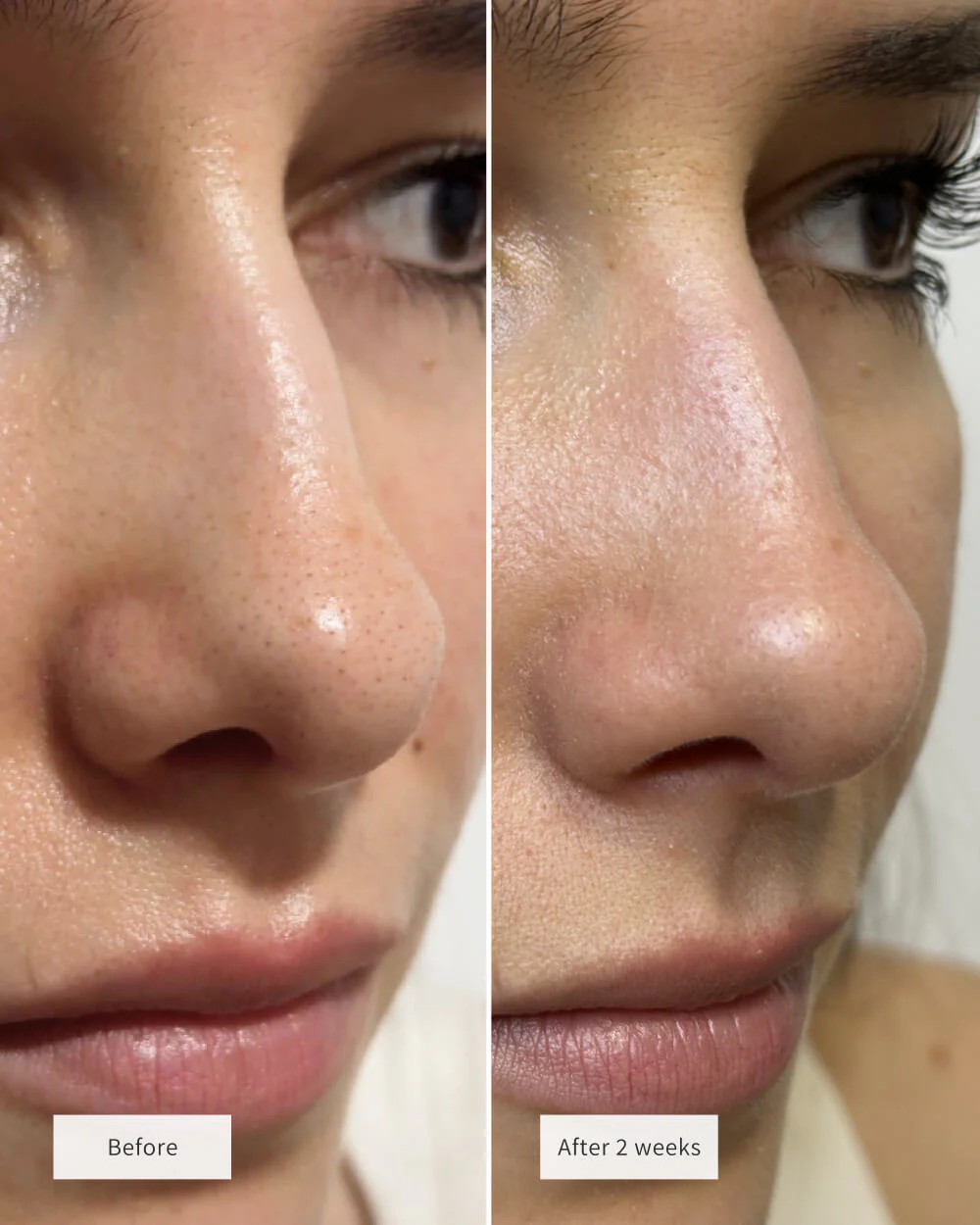 CLEAR PORE DUO - Image 2