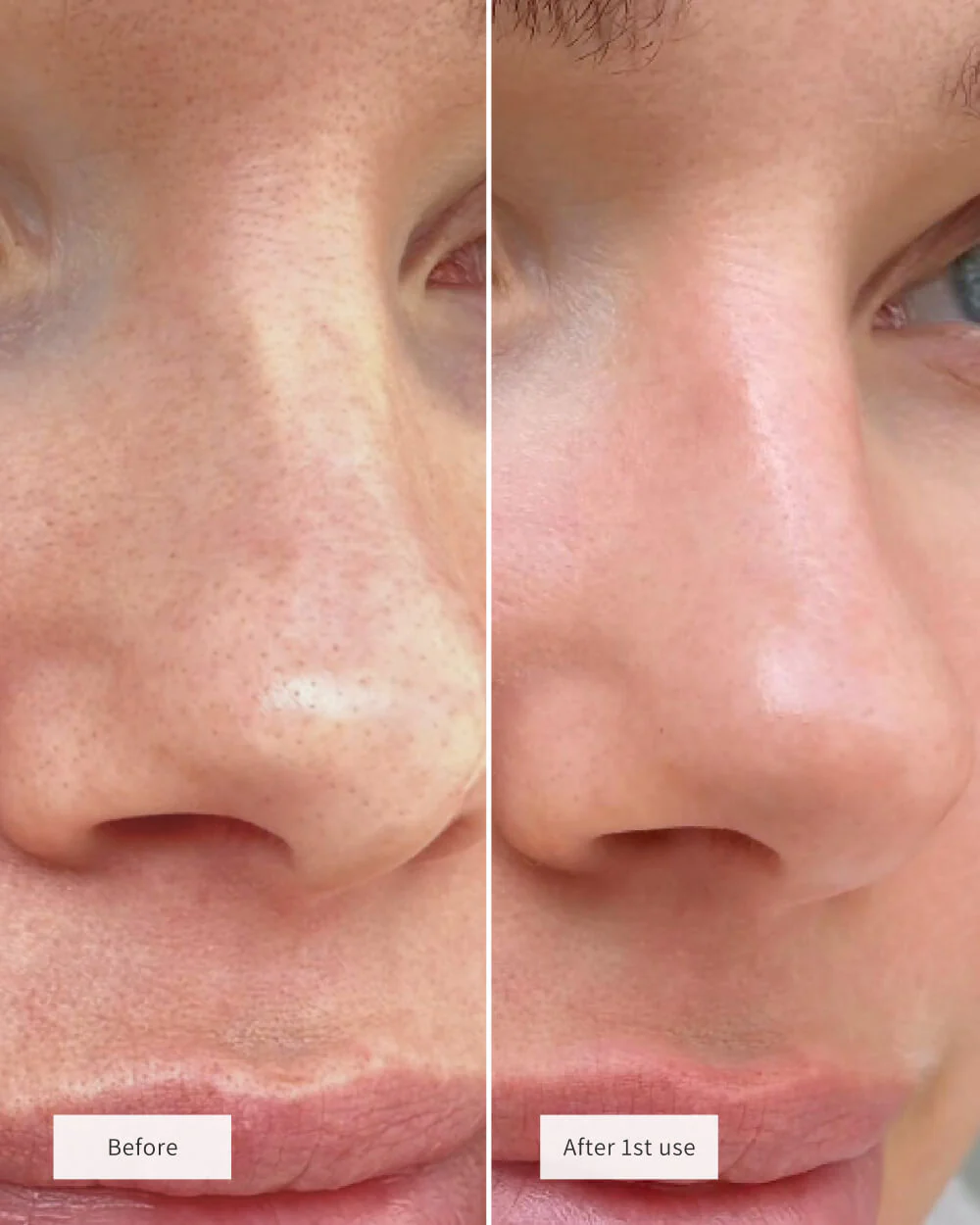 SALICYLIC ACID EXFOLIANT - Image 2